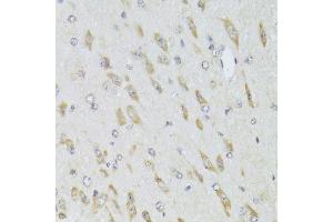Immunohistochemistry of paraffin-embedded mouse brain using RPL13 Antibody. (RPL13 抗体  (AA 1-211))