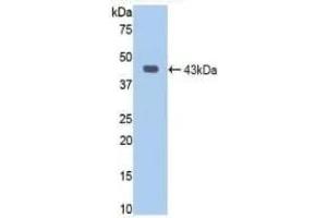 Detection of Recombinant JAG1, Human using Polyclonal Antibody to Jagged 1 (JAG1) (JAG1 抗体  (AA 470-834))