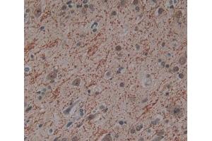 Used in DAB staining on fromalin fixed paraffin- embedded Kidney tissue (PITPNB 抗体  (AA 2-271))