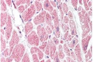 Immunohistochemistry (Paraffin-embedded Sections) (IHC (p)) image for anti-Prostaglandin I2 (Prostacyclin) Synthase (PTGIS) (AA 475-490) antibody (ABIN2451652)