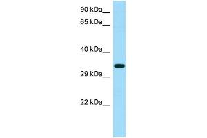 WB Suggested Anti-RBFA Antibody Titration: 1. (RBFA 抗体  (C-Term))