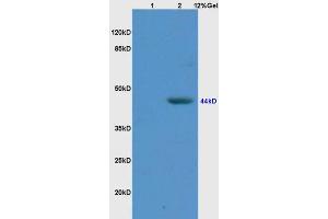 L1 rat brain lysates L2 human colon carcinoma lysates probed with Anti IL-2R gamma/CD132 Polyclonal Antibody, Unconjugated (ABIN735248) at 1:200 overnight at 4 °C.