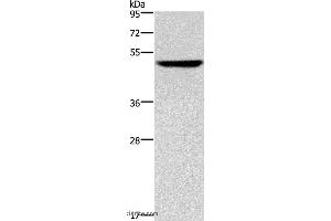 Western blot analysis of Hela cell, using KRT16 Polyclonal Antibody at dilution of 1:350 (KRT16 抗体)