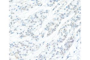 Immunohistochemistry (IHC) image for anti-Cyclin C (CCNC) (AA 233-283) antibody (ABIN7453580) (Cyclin C 抗体  (AA 233-283))