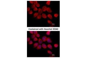 ICC/IF Image Immunofluorescence analysis of paraformaldehyde-fixed A431, using Transketolase, antibody at 1:500 dilution. (TKT 抗体)