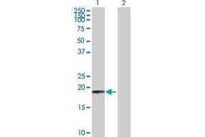 Western Blot analysis of COMMD1 expression in transfected 293T cell line by COMMD1 MaxPab polyclonal antibody. (COMMD1 抗体  (AA 1-190))