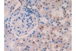 Used in DAB staining on fromalin fixed paraffin- embedded stomach tissue (PIGR 抗体  (AA 343-447))