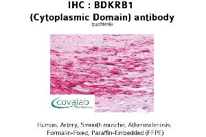 Image no. 1 for anti-Bradykinin Receptor B1 (BDKRB1) (1st Cytoplasmic Domain) antibody (ABIN1732268) (BDKRB1 抗体  (1st Cytoplasmic Domain))