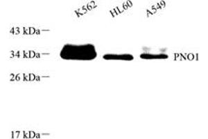 Western blot analysis of PNO1 (ABIN7074991),at dilution of 1: 1000 (PNO1 抗体)