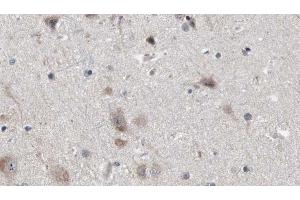 ABIN6272884 at 1/100 staining Human brain cancer tissue by IHC-P. (NDE1 抗体  (N-Term))