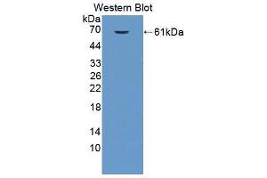 Western blot analysis of the recombinant protein. (EPRS 抗体  (AA 1007-1512))