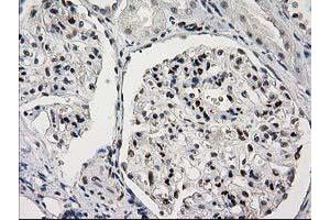 Image no. 8 for anti-Protein Kinase C, epsilon (PRKCE) antibody (ABIN1500229)