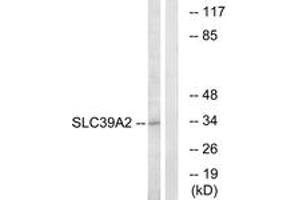 Western blot analysis of extracts from Jurkat cells, using SLC39A2 Antibody. (ZIP2 抗体  (AA 11-60))