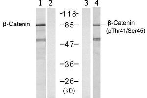 Western blot analysis of extracts from SW626 cell using β-Catenin (Ab-41/45) antibody (E021103, Lane 1 and 2) and β-Catenin (phospho-Thr41/Ser45) antibody (E011116, Lane 3 and 4). (beta Catenin 抗体)