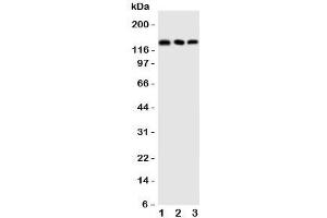 Western blot testing of COL1A1 antibody and Lane 1:  rat skeletal muscles;  2: (r) heart;  3: (r) testis tissue lysate.