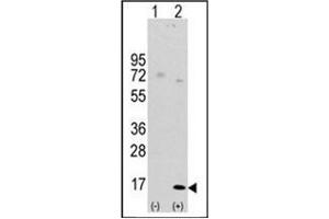 Western blot analysis of LC3 (APG8a) (arrow) using Autophagy LC3 Antibody (APG8a) (D106) Cat. (MAP1LC3A 抗体  (AA 92-121))