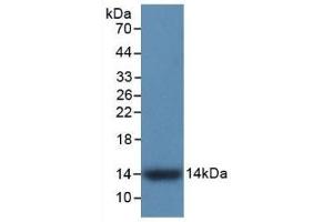 Detection of Recombinant S100A9, Human using Monoclonal Antibody to S100 Calcium Binding Protein A9 (S100A9) (S100A9 抗体  (AA 1-114))