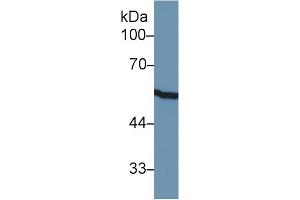 Western Blot; Sample: Rat Small intestine lysate; Primary Ab: 1µg/ml Rabbit Anti-Rat KRT8 Antibody Second Ab: 0.
