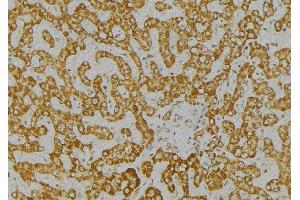 ABIN6276621 at 1/100 staining Mouse liver tissue by IHC-P. (ITPA 抗体  (Internal Region))