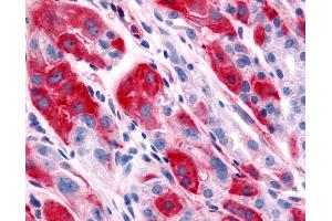 Anti-DPP7 / DPP2 antibody IHC of human stomach. (DPP7 抗体  (Extracellular Domain))