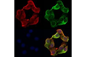 ABIN6263783 and ABIN6266750 staining Hela by IF/ICC.