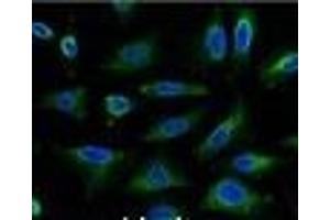 Immunofluorescence analysis of Hela tissue using AQP4 Monoclonal Antibody at dilution of 1:100. (Aquaporin 4 抗体)
