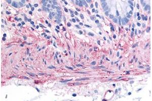 Human Colon, Smooth Muscle (formalin-fixed, paraffin-embedded) stained with TACR2 antibody ABIN213476 at 40 ug/ml followed by biotinylated goat anti-rabbit IgG secondary antibody ABIN481713, alkaline phosphatase-streptavidin and chromogen. (TACR2 抗体  (C-Term))
