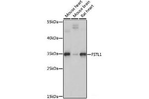Western blot analysis of extracts of various cell lines using FSTL1 Polyclonal Antibody at dilution of 1:1000. (FSTL1 抗体)