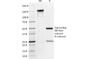 SDS-PAGE Analysis Purified CD86 Mouse Monoclonal Antibody (BU63). (CD86 抗体)