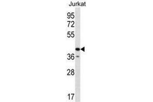 GORASP2 Antibody (Center) western blot analysis in Jurkat cell line lysates (35µg/lane). (GORASP2 抗体  (Middle Region))