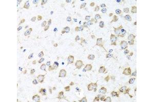 Immunohistochemistry (Paraffin-embedded Sections) (IHC (p)) image for anti-Ribosomal Protein L36 (RPL36) antibody (ABIN7263819)