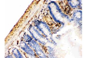 Galectin 1 was detected in paraffin-embedded sections of mouse intestine cancer tissues using rabbit anti- Galectin 1 Antigen Affinity purified polyclonal antibody (Catalog # ) at 1 ? (LGALS1/Galectin 1 抗体  (AA 2-135))