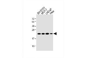 All lanes : Anti-RK7 Antibody (C-term) at 1:2000 dilution Lane 1: SH-SY5Y whole cell lysate Lane 2: MCF-7 whole cell lysate Lane 3: LNCaP whole cell lysate Lane 4: Hela whole cell lysate Lysates/proteins at 20 μg per lane. (PARK7/DJ1 抗体  (C-Term))