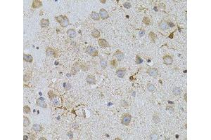 Immunohistochemistry of paraffin-embedded Mouse brain using NAT8 Polyclonal Antibody (NAT8 抗体)