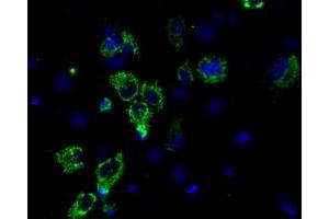 Anti-ACO2 mouse monoclonal antibody (ABIN2452696) immunofluorescent staining of COS7 cells transiently transfected by pCMV6-ENTRY ACO2 (RC204307). (ACO2 抗体)