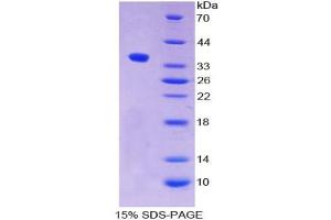 SDS-PAGE analysis of Human ALPPL2 Protein. (ALPPL2 蛋白)