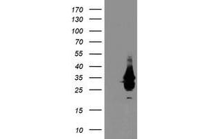 Western Blotting (WB) image for anti-Single-Stranded DNA Binding Protein 1 (SSBP1) antibody (ABIN1499909) (SSBP1 抗体)