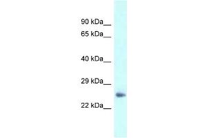 WB Suggested Anti-Dpt Antibody   Titration: 1. (Dermatopontin 抗体  (N-Term))