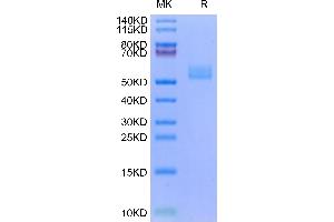 Human ICOS (Q50A) on Tris-Bis PAGE under reduced condition. (ICOS Protein (AA 21-141) (Fc Tag))