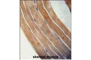 Immunohistochemistry (Paraffin-embedded Sections) (IHC (p)) image for anti-Elongation Factor Tu GTP Binding Domain Containing 1 (EFTUD1) (AA 1062-1090), (C-Term) antibody (ABIN654331)