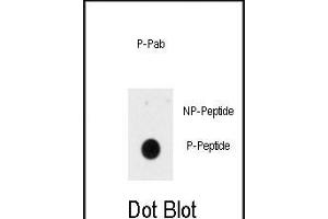 Dot blot analysis of anti-Phospho-INSR-p Antibody (ABIN389937 and ABIN2839751) on nitrocellulose membrane. (Insulin Receptor 抗体  (pTyr1185))