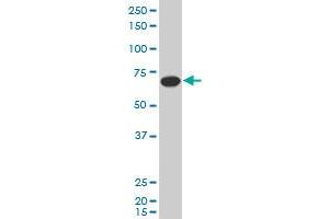 SLC27A5 polyclonal antibody (A01), Lot # 060703JCS1. (SLC27A5 抗体  (AA 90-175))