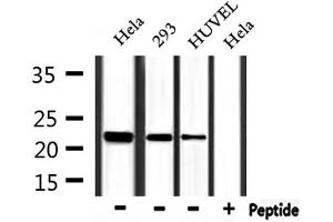 Western blot analysis of extracts from Hela,293 and HUVEC, using FTH1 Antibody. (FTH1 抗体  (C-Term))