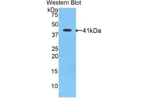 Western blot analysis of the recombinant protein. (Angiotensin III 抗体  (AA 33-145))