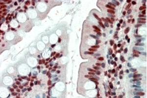 Immunohistochemistry (IHC) image for anti-Ewing Sarcoma Breakpoint Region 1 (EWSR1) antibody (ABIN5864986) (EWSR1 抗体)