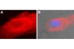 Immunocytochemistry (ICC) image for anti-ATPase, Ca++ Transporting, Cardiac Muscle, Slow Twitch 2 (ATP2A2) (AA 498-510) antibody (ABIN7042954)