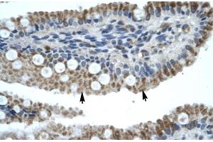 Human Intestine (ZNF683 抗体  (N-Term))