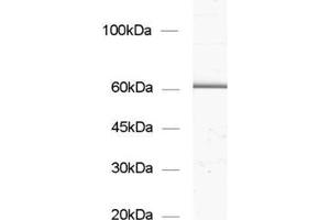 dilution: 1 : 1000, sample: synaptic vesicle fraction of rat brain (LP2) (GAD65 抗体  (AA 3-96))