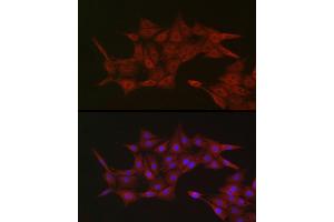 Immunofluorescence (IF) image for anti-Karyopherin (Importin) beta 1 (KPNB1) (AA 250-350) antibody (ABIN6142997)
