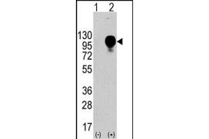 Western blot analysis of LP2 (arrow) using LP2 Antibody (Center) (ABIN388569 and ABIN2849749). (LAMP2 抗体  (AA 196-225))